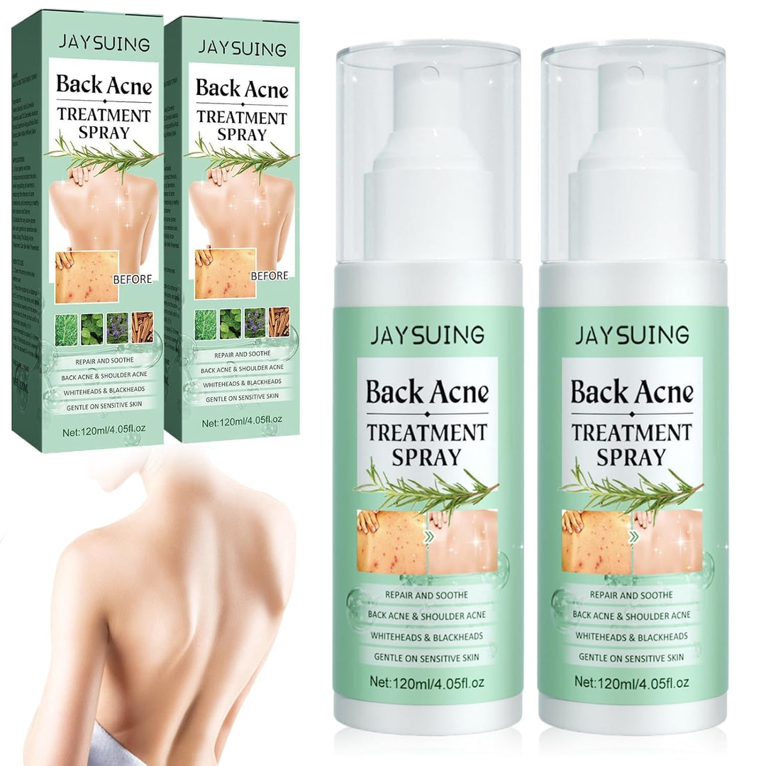 Spray de Tratamento para Acne Corporal