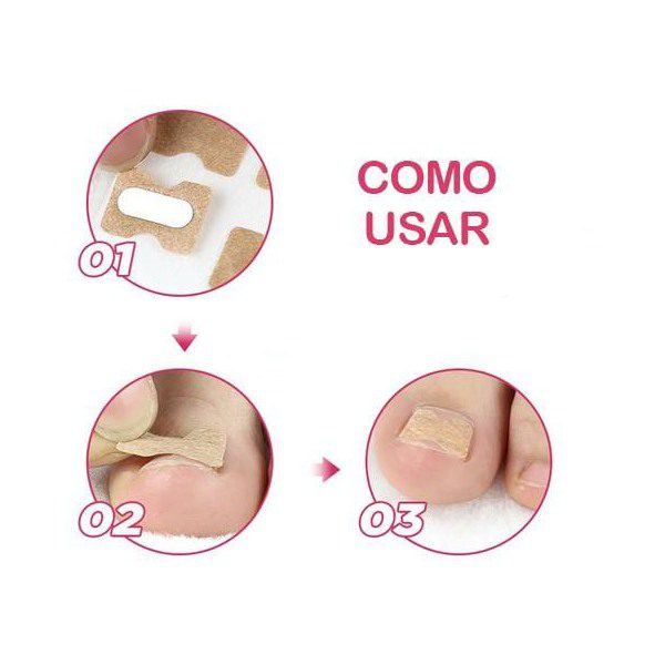 Adesivo Corretor de Unhas Encravadas - PACK 30