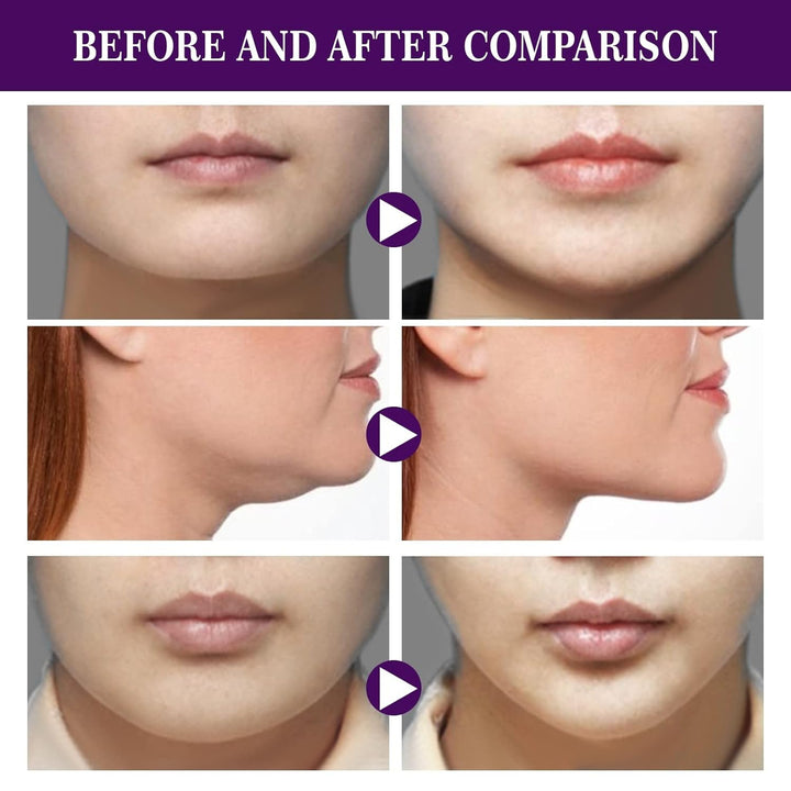 Adesivo para Lifting Facial (120 unidades)