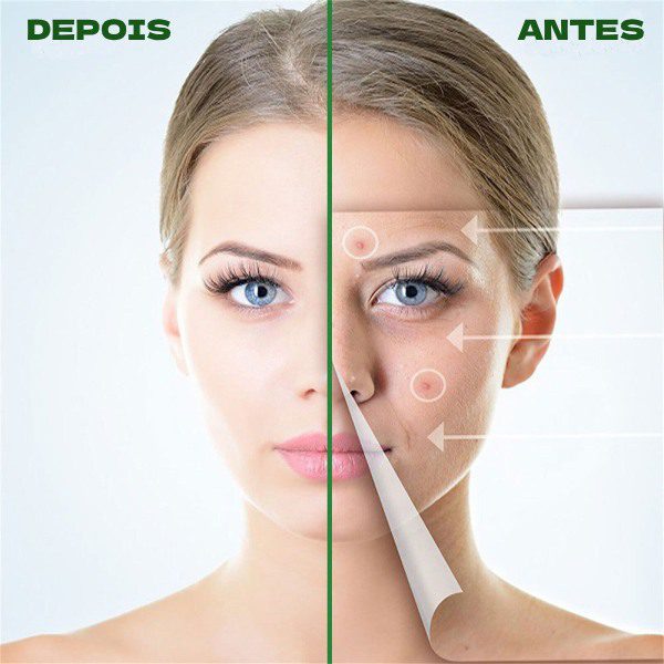 Adesivos Hidrocolóide para Acne - Pack 72