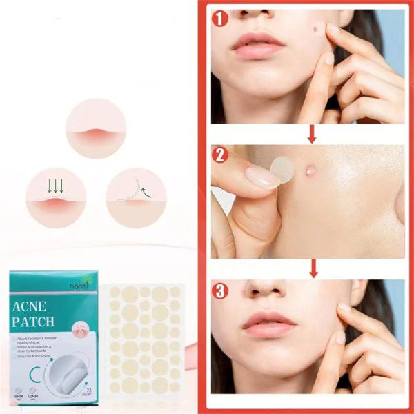 Adesivos Hidrocolóide para Acne - Pack 72