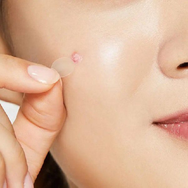 Adesivos Hidrocolóide para Acne - Pack 72