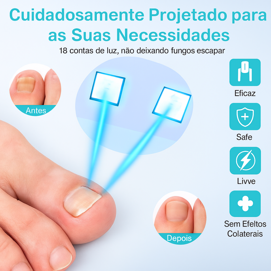 Dispositivo Laser Antifungos para Unhas