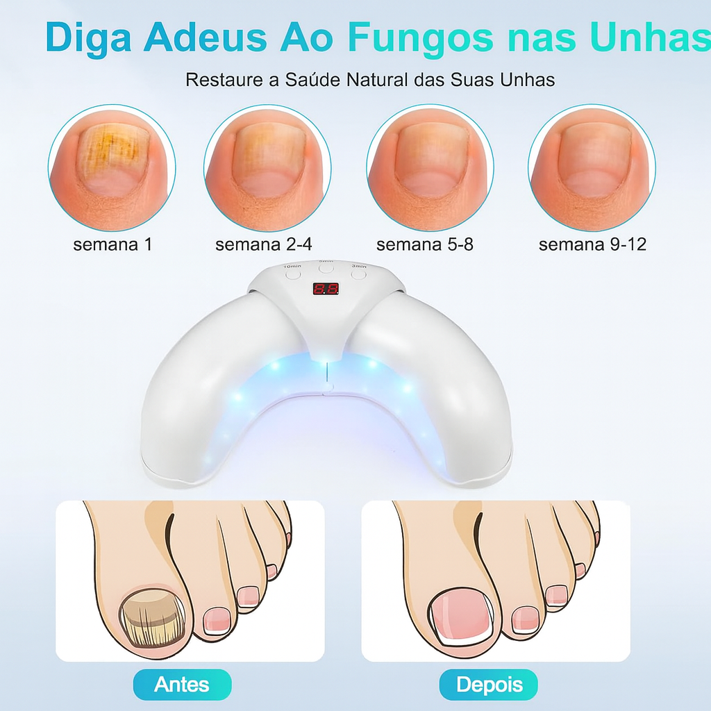 Dispositivo Laser Antifungos para Unhas
