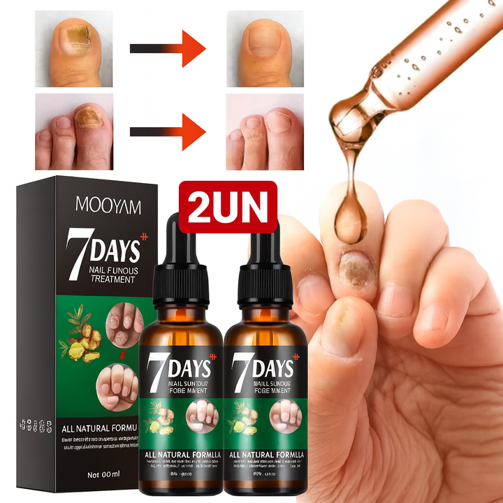 Tratamento de 7 Dias para Fungos das Unhas - 2 UN