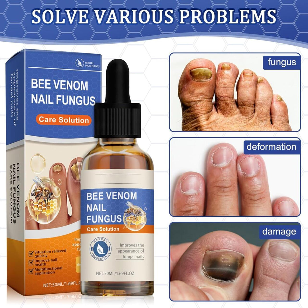 Tratamento Anti-Fungos e Micoses - Veneno de Abelhas